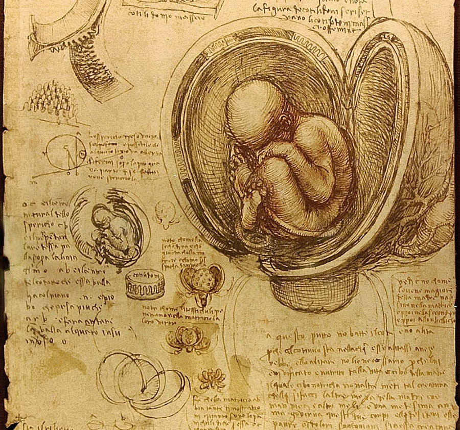 l3